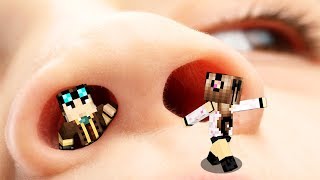 Entriamo Dentro Il Naso Su Minecraft