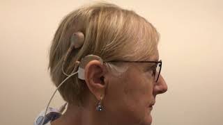 My Activation Maps For Communication With Acquired Hearing Loss