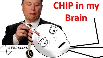 Human Brain connected with Computers (wireless) first implant (chip) -  Neuralink - Elon Musk