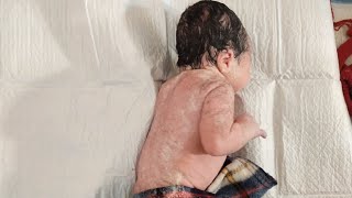 Newborn baby fully covered in white cheese vernix Caseosa just after birth