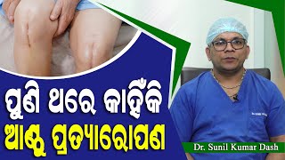Revision of Knee Replacement Surgery | Dr. Sunil Kumar Dash