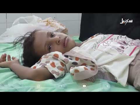 مستشفيات أبين ترفع الراية البيضاء أمام الحصبة