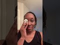 Procedure is done-Chalazion removal | #Shorts