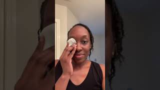 Procedure is done-Chalazion removal | #Shorts