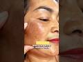 ✨ Glowing skin starts here! 🔥 Fade dark spots, reduce pigmentation & reveal your natural glow. 💖