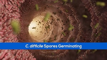 C. Difficile Infection - Germination of Spores in the Small Intestine