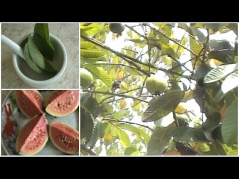 Video Nyeri Sendi Masuk Angin