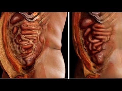 Alimentos que ayudan a desinflamar el colon