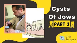 Cysts of Jows, Oral ( Part #3 ) | د. محمد عادل