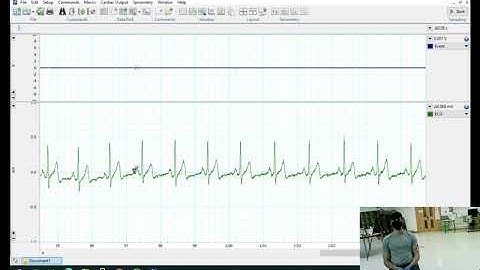 ECG Lab - Data recording and measurement (Dr Brian Carson)