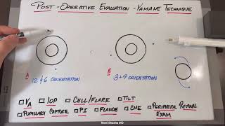 Post-Operative Evaluation for the Yamane Technique