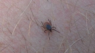 Kleszcz Pospolity Ixodes Ricinus