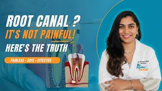 Root Canal Treatment Explained | Is Root Canal Painful? | Symptoms, Procedure & Cost