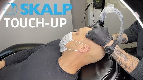 Skalp® Scalp Micropigmentation Touch-up