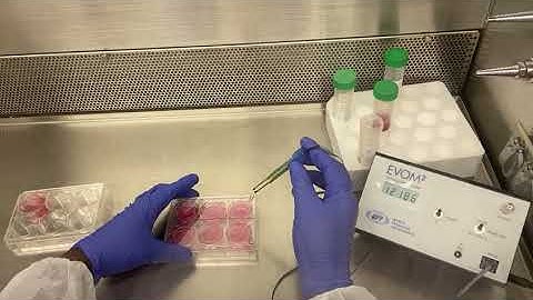 Calculating Blank R  TEER