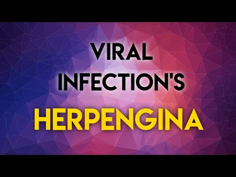 VIRAL INFECTIONS - HERPENGINA