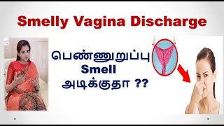 Smelly Vaginal Discharge | STD Infections | பெண்ணுறுப்பு Smell அடிக்குதா | Dr. Deepa Ganesh.