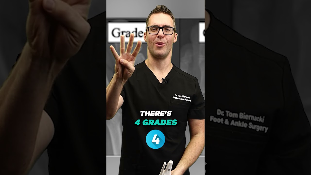 Hallux Rigidus vs Tailor's Bunion vs Bunion, PAIN! [ Diagnosis, Is Bunion Surgery Worth It?]