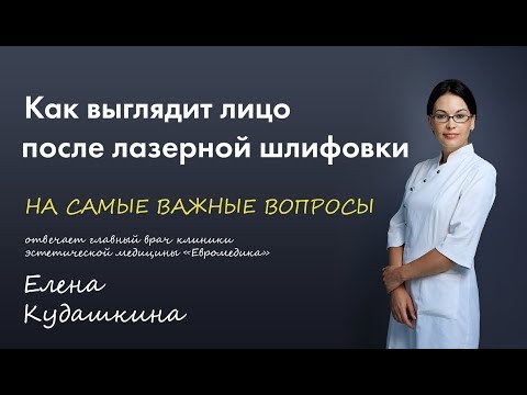 Как выглядит лицо после лазерной шлифовки