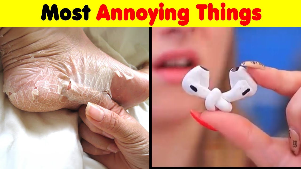 The Most ANNOYING Thing You'll See Today YouTube