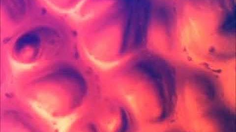 Water drops on hydrogel