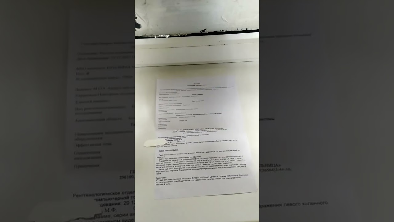 Бабушки Маши описали КТ ноги.