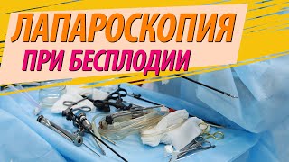 Лапароскопия при бесплодии. ЖЕНСКОЕ БЕСПЛОДИЕ 💊