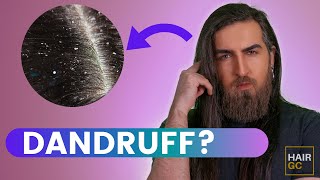How To Treat Dandruff 3 Home Remedies