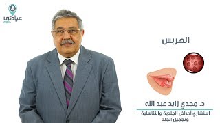 الهربس مع د. مجدي زايد عبد الله _ دكتور جلدية وتناسلية بالمعادي