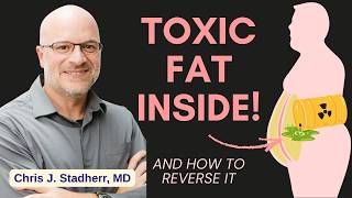Are you Loaded with Visceral Fat? Why it Matters & How to Reverse It | Chris Stadtherr, MD