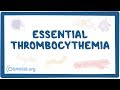 Essential thrombocythemia - causes, symptoms, diagnosis, treatment, pathology