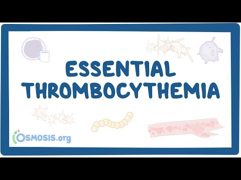 ترومبوسیتمی ضروری - علل، علائم، تشخیص، درمان، آسیب شناسی