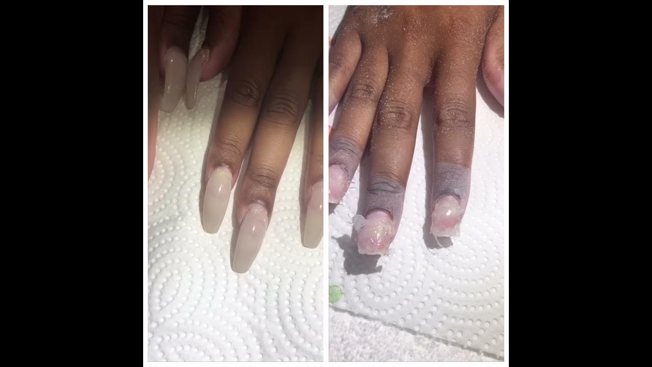 Illegal acrylic nails ( MMA , Google it ) YouTube