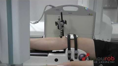 GNRB Radio Arthrometer - ACL diagnostic (anterior drawer test coupled with x-ray technology)
