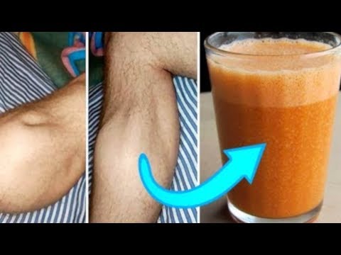 Wideo: Czy sok z marynaty pomoże w skurczach nóg?
