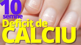 Cum ?tii c? ai Deficit de CALCIU: 10 semne