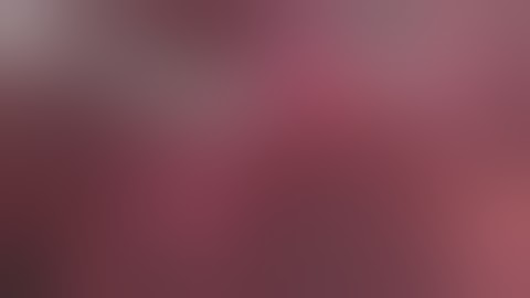 Inferior Hypogastric Nerve Iatrogenic Section During Endometriosis Resection 1, 37s