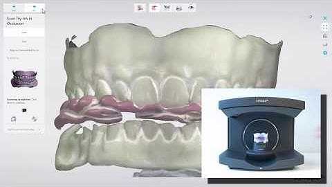 3Shape Dental System - Designing Better Dentures Using Try-ins