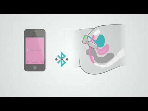 How The PeriCoach System Works - video from PeriCoach