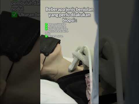 Video: Kelenjar getah bening mana yang membengkak akibat kanker tiroid?