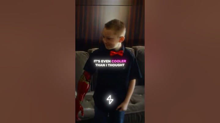 Iron Man Gifted This Kid A Bionic Arm…❤️🦾