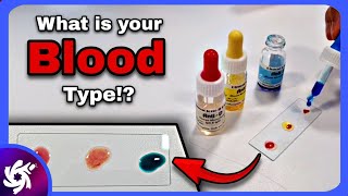 Blood Typing Experiment How To Know My Body Type