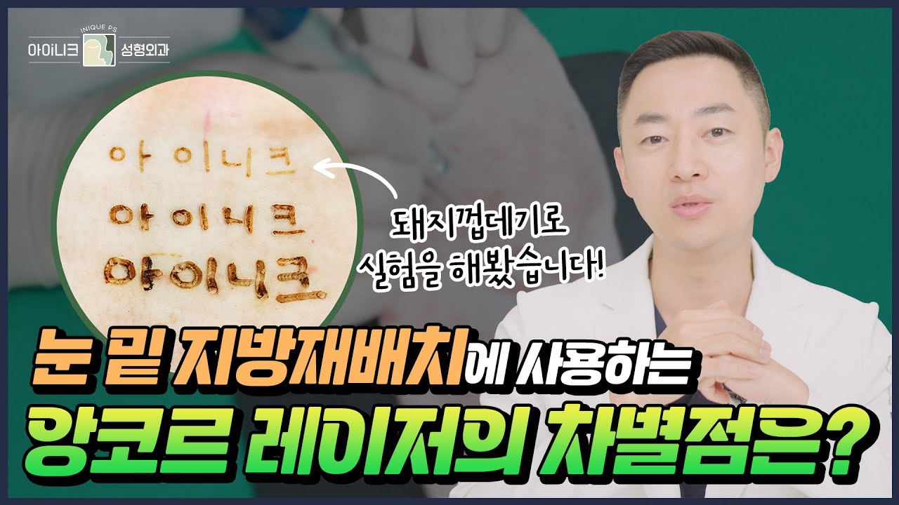 울트라 펄스 앙코르 레이저 VS 일반 레이저! 본격 비교영상😎