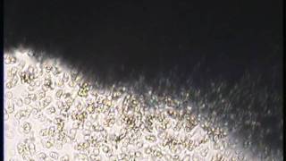 Bions From An Iron Filing After Wilhelm Reich