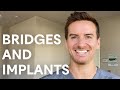 The pros and cons of dental bridges and implants