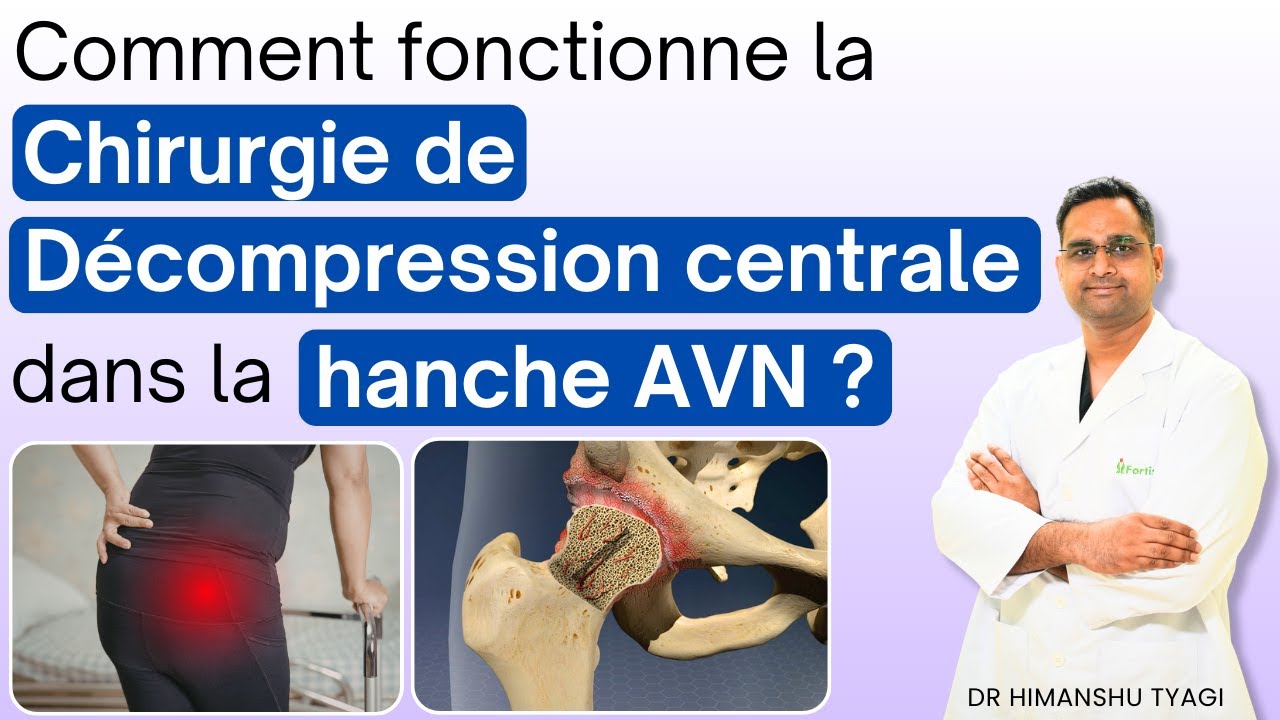 Comment fonctionne la chirurgie de décompression centrale dans la hanche AVN ?