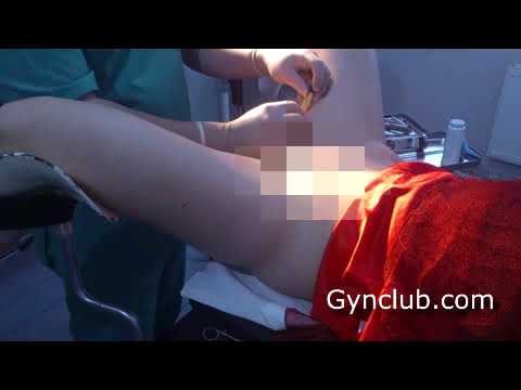 Gyno medical exam