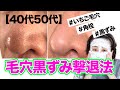 【40代50代毛穴黒ずみ撃退法】月１回の毛穴大掃除。角質角栓除去！いちご毛穴キレイさっぱり透明感肌を手に入れる！