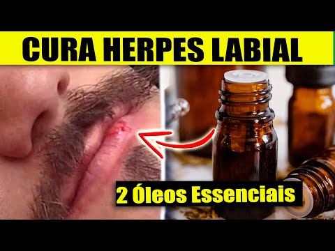 Vídeo: Como tratar o herpes labial: os óleos essenciais podem ajudar?