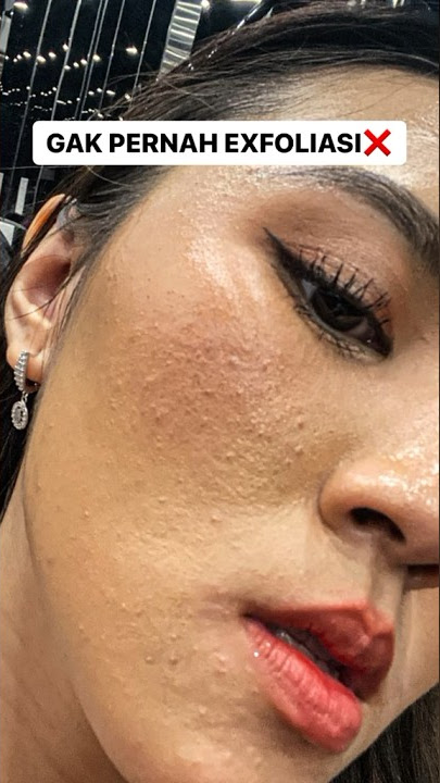 Recommended Serums for Textured Skin || Treating Textured Skin ✅